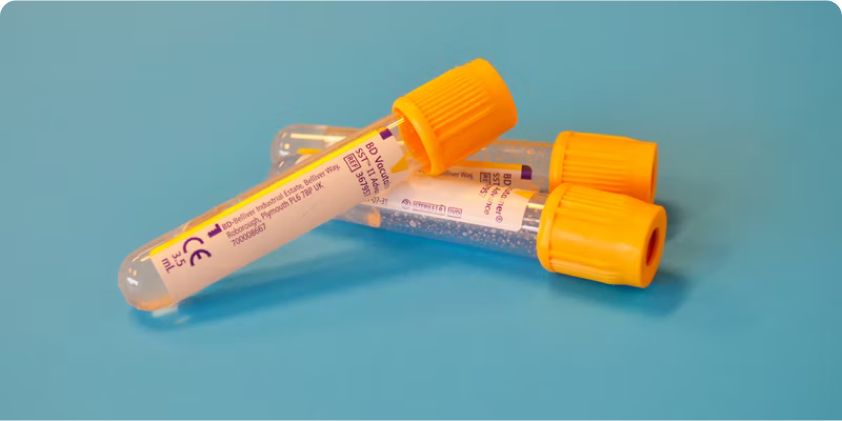 Understanding Drug Test Results